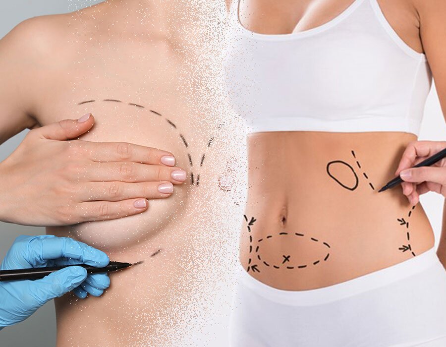 Masters Course in Liposuction and Breast Aesthetics