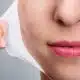 Chemical Peels Treatment